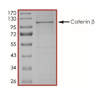 The purity of Catenin beta was determined to be > 80 % by densitometry.